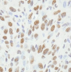 FUS Antibody, Novus Biologicals 0.1mL; Unlabeled:Antibodies, Polyclonal